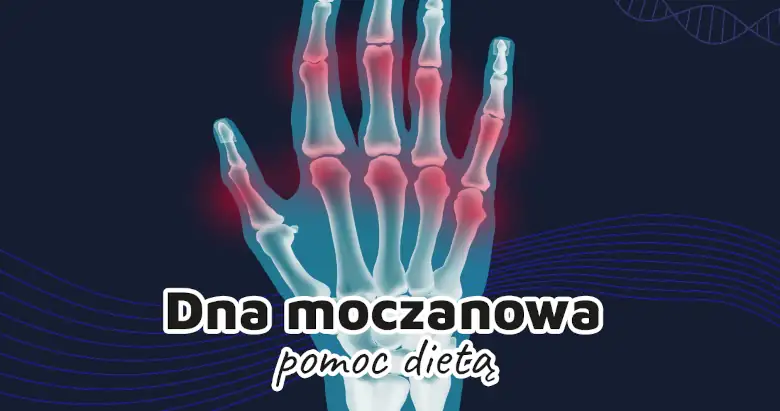 dna moczanowa